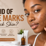 How Do I Get Rid of Acne Marks on Black Skin